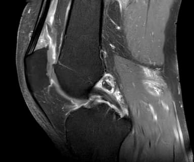 MRI second opinion