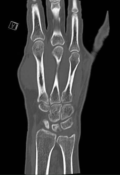 CT second opinion