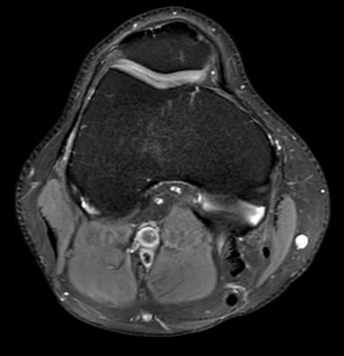 MRI second opinion