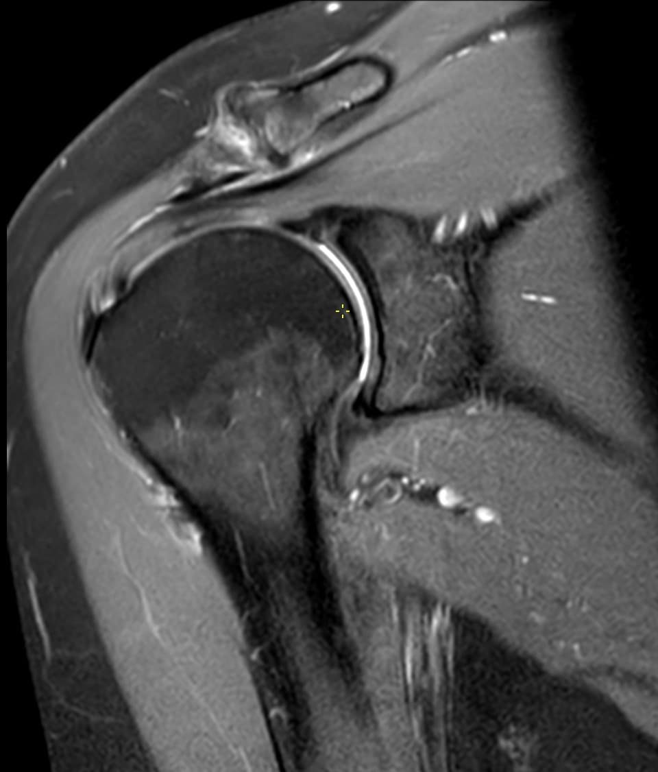 When to request a musculoskeletal second opinion