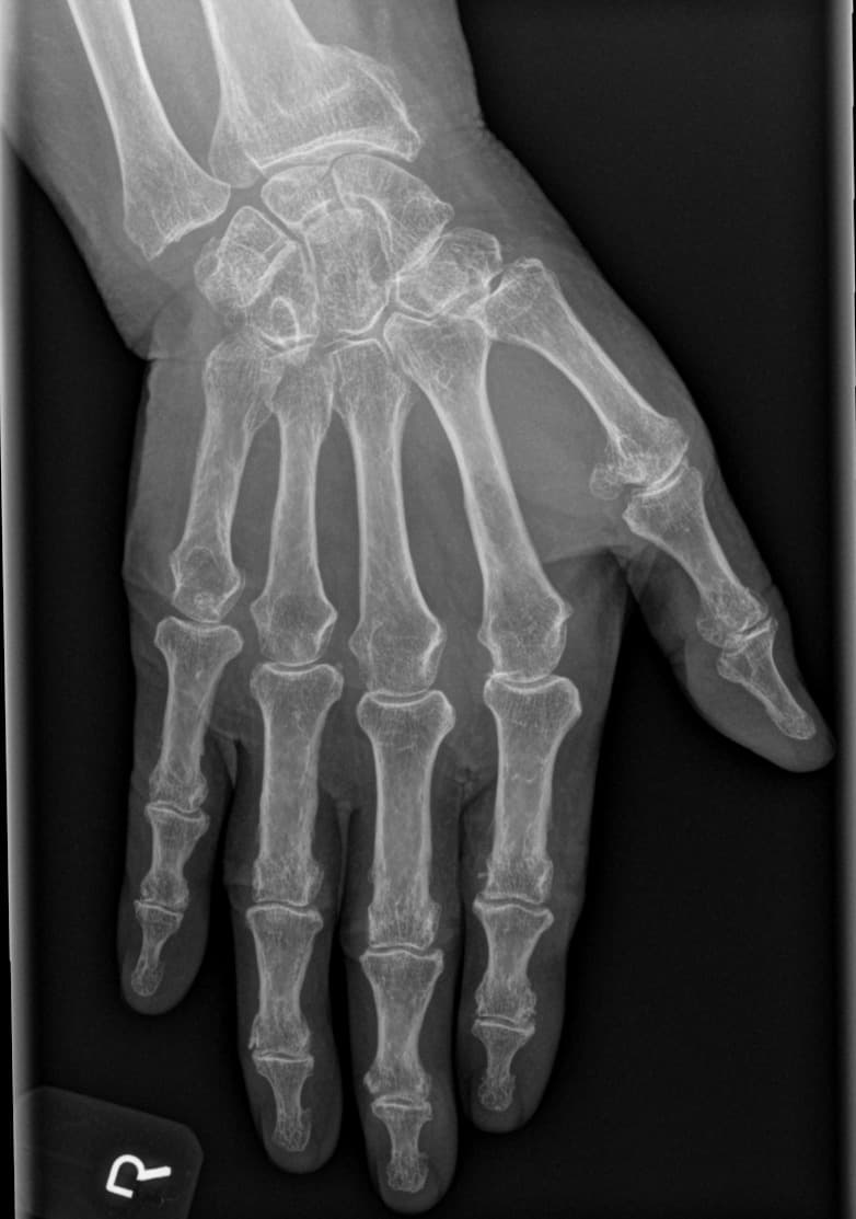 X-ray alignment and fracture red flags in follow-up